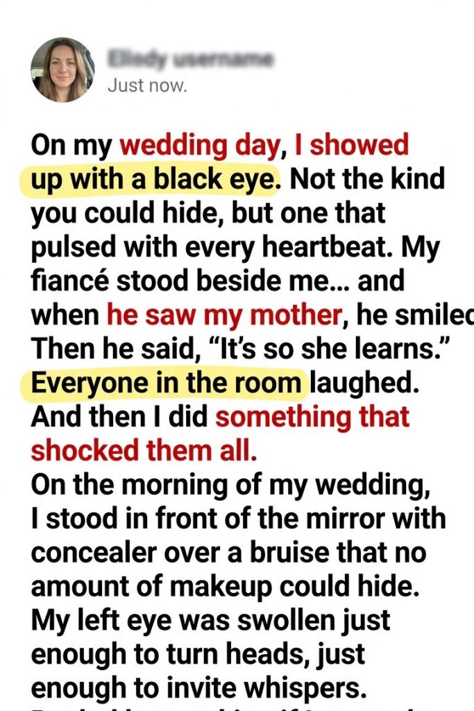 On My Wedding Day, I Had a Black Eye—But When My Fiancé Spoke, I Realized the Truth and Walked Away Forever