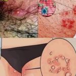 What Is HPV? Key Facts You Should Know